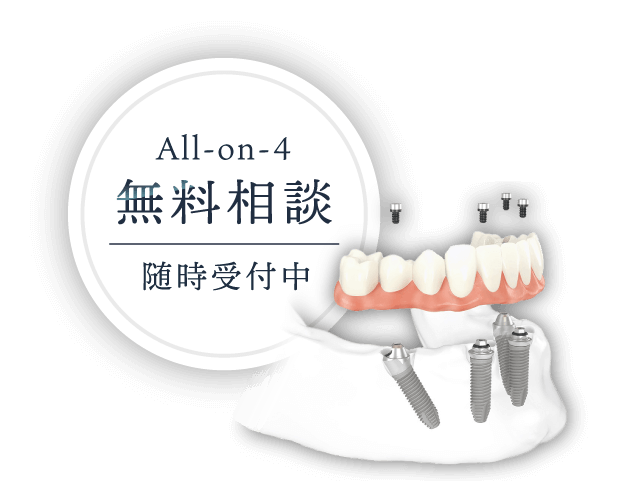 All-on-4 無料相談 随時受付中