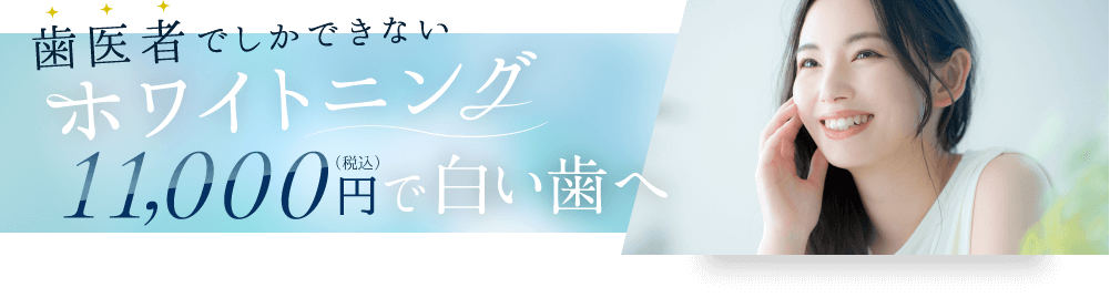 歯医者でしかできないホワイトニング　＜平日限定＞5,500円（税込）で白い歯へ