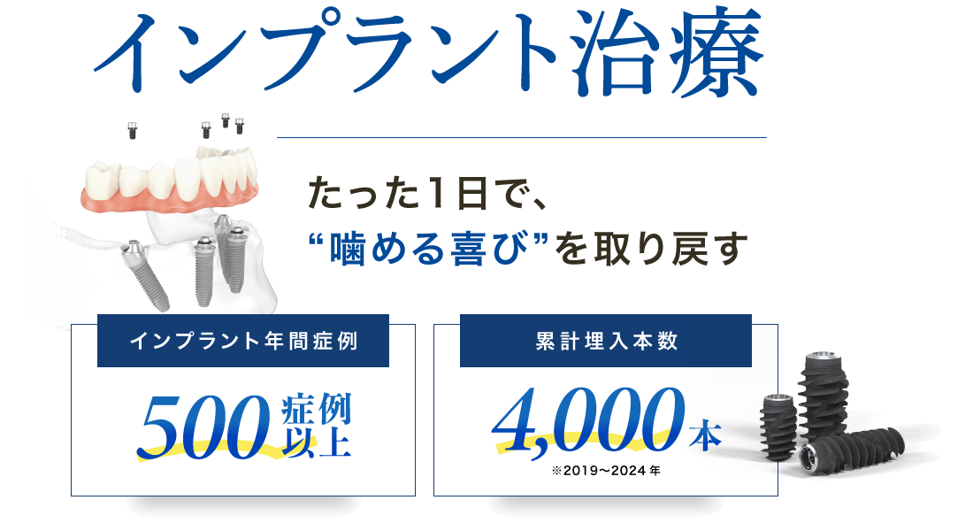 インプラント治療：たった1日で、“噛める喜び”を取り戻す