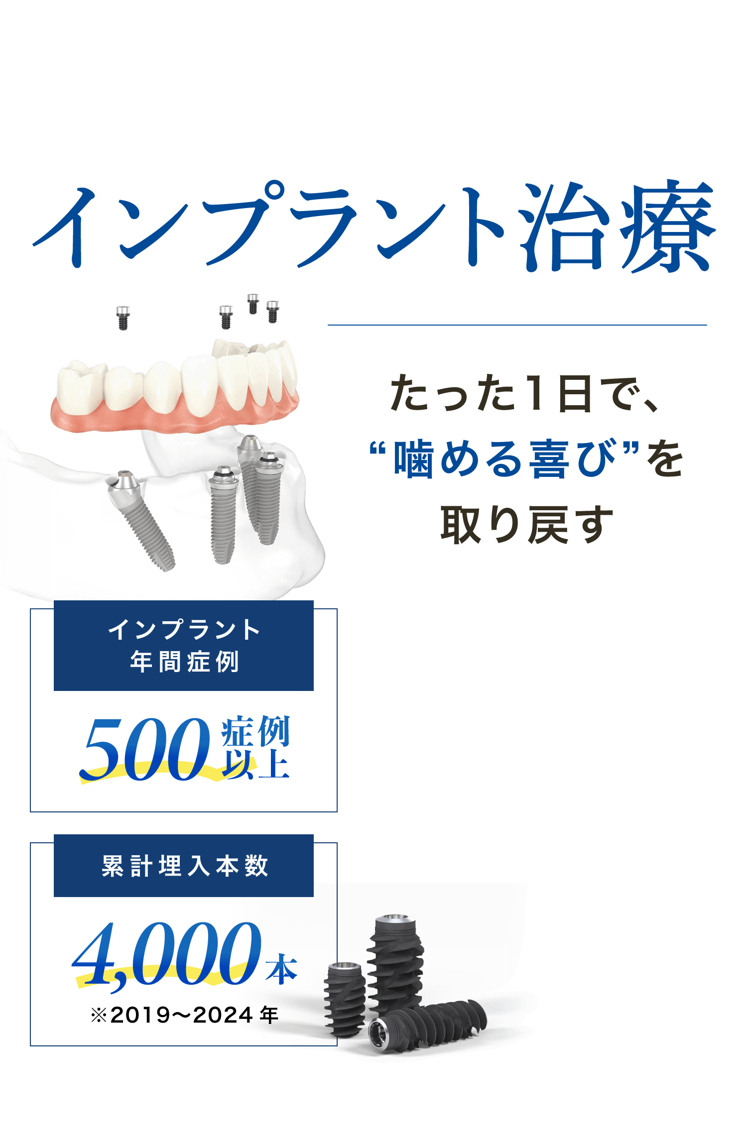 インプラント年間症例：500症例以上、累計埋入本数：4,000本（※2019〜2024年）