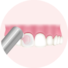 歯の表面をツルツルに仕上げ磨き